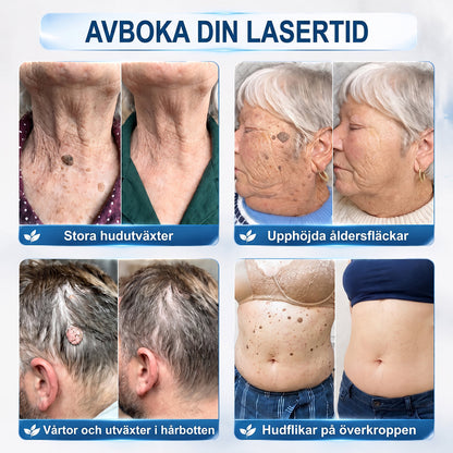 𝐇𝐈𝐒𝐊𝐈𝐍®👩‍⚕️ 𝟕-𝐝𝒂𝙜𝙖𝙧𝙨 𝐛𝐞𝐡𝐚𝐧𝐝𝐥𝐢𝐧𝐠 𝐦𝐨𝐭 𝐡𝐮𝐝𝐟𝐥𝐢𝐤𝐚𝐫 & 𝐡𝐮𝐝𝐟𝐥ä𝐜𝐤𝐚𝐫 – 𝐀𝐯𝐚𝐧𝐜𝐞𝐫𝐚𝐝 𝐫𝐨𝐥𝐥-𝐨𝐧-𝐩𝐞𝐧𝐧𝐚 𝐟ö𝐫 𝐬𝐦ä𝐫𝐭𝐟𝐫𝐢 𝐛𝐨𝐫𝐭𝐭𝐚𝐠𝐧𝐢𝐧𝐠 𝐚𝐯 𝐡𝐮𝐝𝐟ö𝐫ä𝐧𝐝𝐫𝐢𝐧𝐠𝐚𝐫 𝐮𝐭𝐚𝐧 ä𝐫𝐫