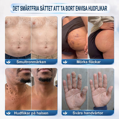 𝐇𝐈𝐒𝐊𝐈𝐍®👩‍⚕️ 𝟕-𝐝𝒂𝙜𝙖𝙧𝙨 𝐛𝐞𝐡𝐚𝐧𝐝𝐥𝐢𝐧𝐠 𝐦𝐨𝐭 𝐡𝐮𝐝𝐟𝐥𝐢𝐤𝐚𝐫 & 𝐡𝐮𝐝𝐟𝐥ä𝐜𝐤𝐚𝐫 – 𝐀𝐯𝐚𝐧𝐜𝐞𝐫𝐚𝐝 𝐫𝐨𝐥𝐥-𝐨𝐧-𝐩𝐞𝐧𝐧𝐚 𝐟ö𝐫 𝐬𝐦ä𝐫𝐭𝐟𝐫𝐢 𝐛𝐨𝐫𝐭𝐭𝐚𝐠𝐧𝐢𝐧𝐠 𝐚𝐯 𝐡𝐮𝐝𝐟ö𝐫ä𝐧𝐝𝐫𝐢𝐧𝐠𝐚𝐫 𝐮𝐭𝐚𝐧 ä𝐫𝐫